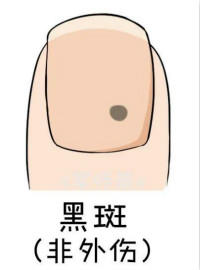 broken image